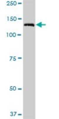 Western Blot: ULK4 Antibody [H00054986-D01P]