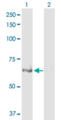 Western Blot: ULK4 Antibody [H00054986-D01P]