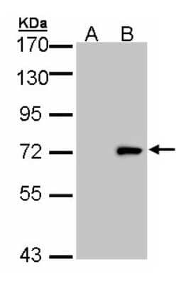 Western Blot: ULK4 Antibody [NBP2-20809]