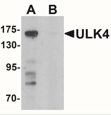 Western Blot: ULK4 AntibodyBSA Free [NBP2-41244]