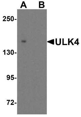 Western Blot: ULK4 AntibodyBSA Free [NBP2-41244]