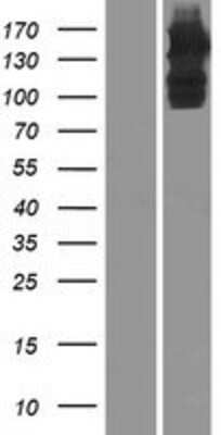 Western Blot: ULK4 Overexpression Lysate [NBP2-06904]