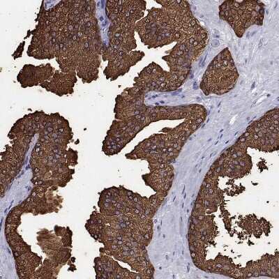 Immunohistochemistry: UMODL1 Antibody [NBP2-38102]