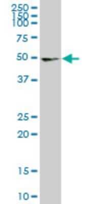 Western Blot: UMPS Antibody (2B10) [H00007372-M06]