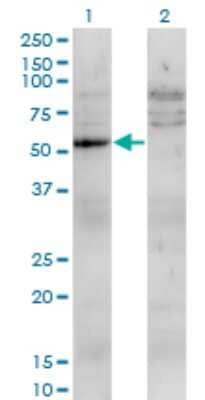 Western Blot: UMPS Antibody (2F5) [H00007372-M05]