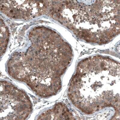 Immunohistochemistry-Paraffin: UMPS Antibody [NBP1-85896]