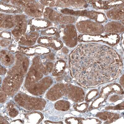 Immunohistochemistry-Paraffin: UMPS Antibody [NBP1-85896]