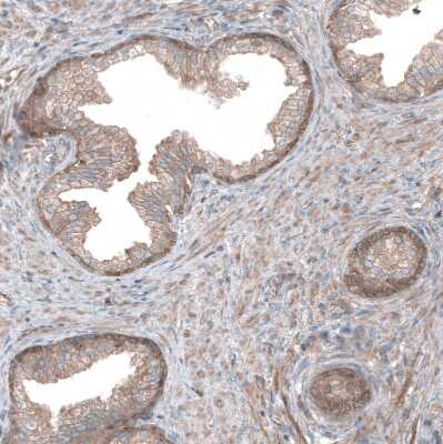 Immunohistochemistry-Paraffin: UMPS Antibody [NBP1-85896]
