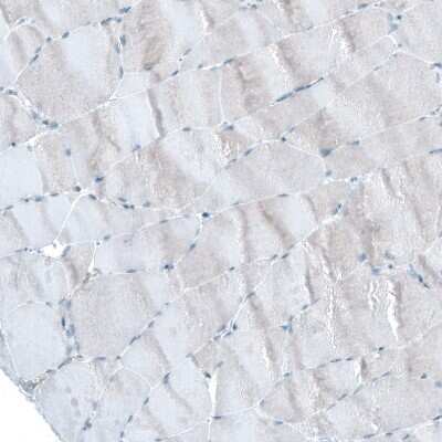 Immunohistochemistry-Paraffin: UMPS Antibody [NBP1-85896]