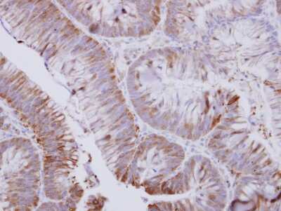 Immunohistochemistry-Paraffin: UMPS Antibody [NBP2-20810]