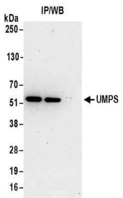 Immunoprecipitation: UMPS Antibody [NBP2-32171]