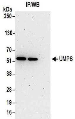 Immunoprecipitation: UMPS Antibody [NBP2-32172]