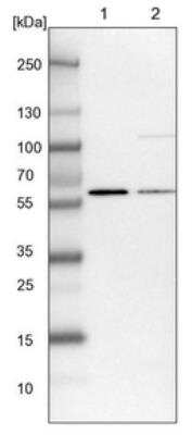 Western Blot: UMPS Antibody [NBP1-85895]