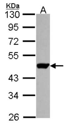 Western Blot: UMPS Antibody [NBP2-20810]