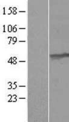 Western Blot: UMPS Overexpression Lysate [NBL1-17609]