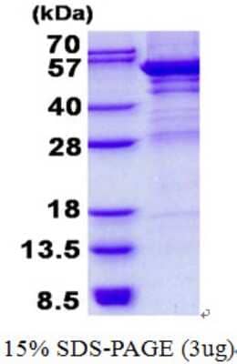 SDS-PAGE: Recombinant Human UMPS His Protein [NBP2-22934]