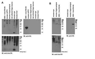 Western Blot: UNC119 Antibody (2F9-2A9) [H00009094-M01]