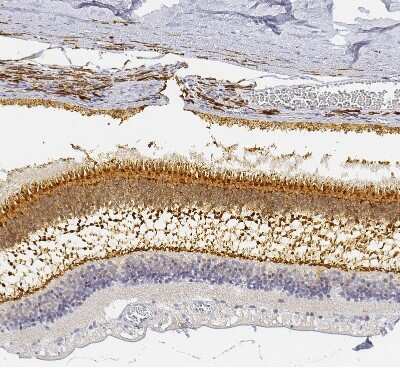 Immunohistochemistry-Paraffin: UNC119 Antibody [NBP1-81708]