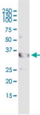 Immunoprecipitation: UNC119 Antibody [H00009094-B01P-50ug]