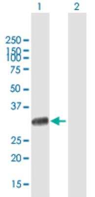 Western Blot: UNC119 Antibody [H00009094-B01P-50ug]