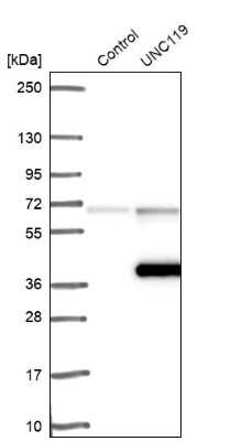 Western Blot: UNC119 Antibody [NBP1-81708]