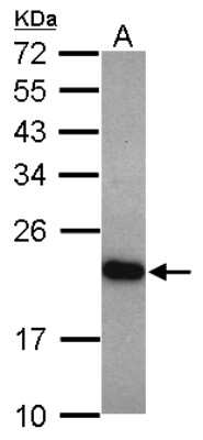 Western Blot: UNC119 Antibody [NBP2-20811]