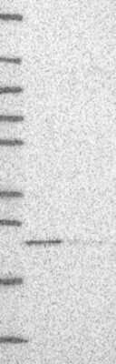 Western Blot: UNC119B Antibody [NBP3-17146]