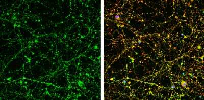 Immunocytochemistry/ Immunofluorescence: UNC13B Antibody [NBP1-33037]