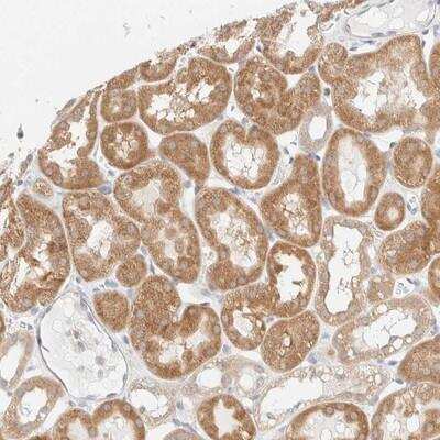 Immunohistochemistry: UNC13B Antibody [NBP1-83244]