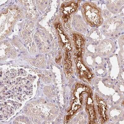 Immunohistochemistry: UNC13B Antibody [NBP2-49364]