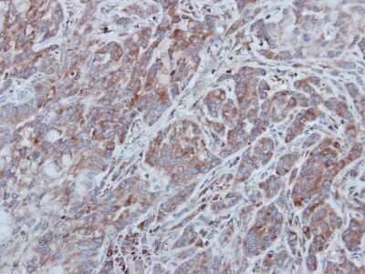 Immunohistochemistry-Paraffin: UNC13B Antibody [NBP1-33037]