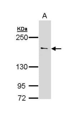 Western Blot: UNC13B Antibody [NBP1-33037]