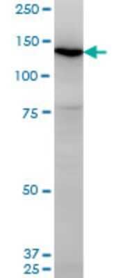 Western Blot: UNC13D/Munc 13-4 Antibody (2C7) [H00201294-M05]