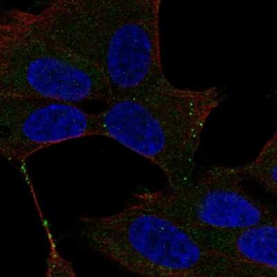 Immunocytochemistry/ Immunofluorescence: UNC13D/Munc 13-4 Antibody [NBP2-57967]