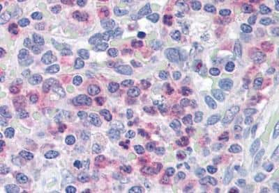 Immunohistochemistry-Paraffin: UNC13D/Munc 13-4 Antibody [NB100-1434]