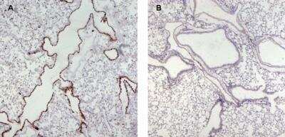 Immunohistochemistry-Paraffin: UNC13D/Munc 13-4 Antibody [NB100-41385]