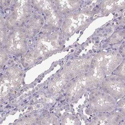 Immunohistochemistry-Paraffin: UNC13D/Munc 13-4 Antibody [NBP2-57827]