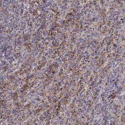 Immunohistochemistry-Paraffin: UNC13D/Munc 13-4 Antibody [NBP2-57827]