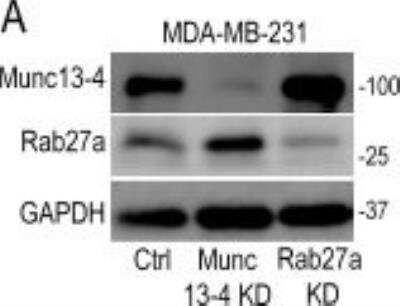Knockdown Validated: UNC13D/Munc 13-4 Antibody [NB100-41385]