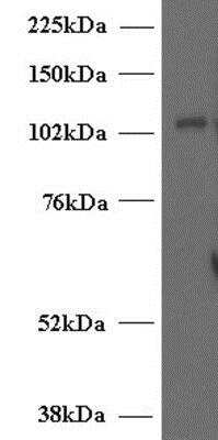 Western Blot: UNC13D/Munc 13-4 Antibody [NB100-41385]