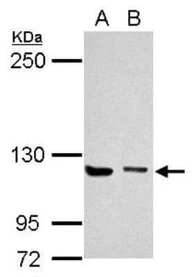 Western Blot: UNC13D/Munc 13-4 Antibody [NBP1-31072]