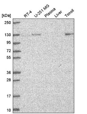 Western Blot: UNC13D/Munc 13-4 Antibody [NBP2-57827]