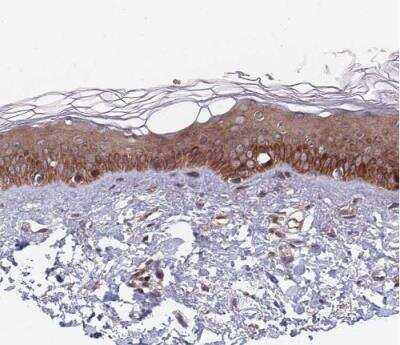 Immunohistochemistry-Paraffin: UNC45A Antibody [NBP2-13506]