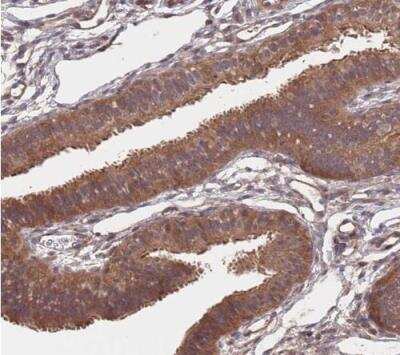 Immunohistochemistry-Paraffin: UNC45A Antibody [NBP2-13506]