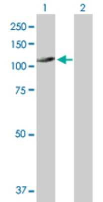 Western Blot: UNC45A Antibody [H00055898-B01P]