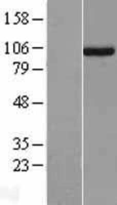 Western Blot: UNC45A Overexpression Lysate [NBL1-17612]