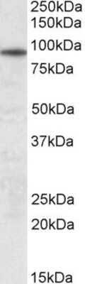 Western Blot: UNC45B Antibody [NBP1-47199]