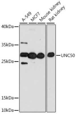 Western Blot: UNC50 AntibodyAzide and BSA Free [NBP2-93822]