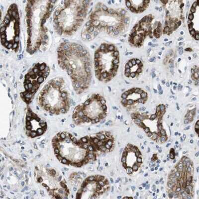 Immunohistochemistry: UNC5CL Antibody [NBP2-47585]