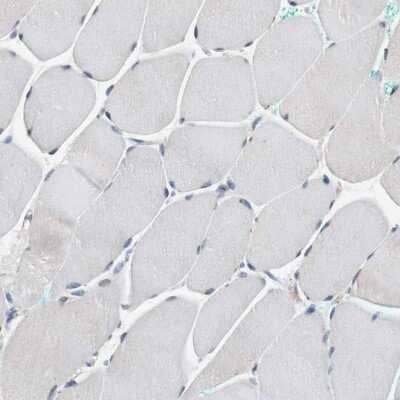 Immunohistochemistry-Paraffin: UNC5CL Antibody [NBP2-47585]